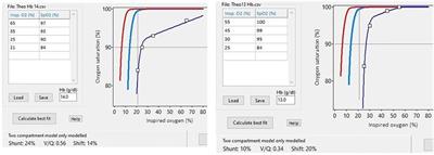 Pathophysiology of gas exchange impairment in extreme prematurity: Insights from combining volumetric capnography and measurements of ventilation/perfusion ratio